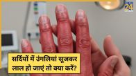 Swollen Fingers