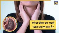 Throat Cancer