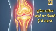 URIC ACID