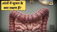 Aant Me sujan