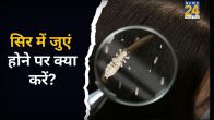 Baalo Mein Juye Hona