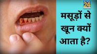 Amla for Oral Health