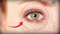 Mole In Eye Meaning Astrology