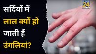 Why Fingers Turned Red In Winter
