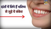 Teeth Gap