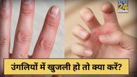 Ungli Me Khujli