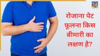 Bloating Gas Causes