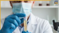 Blood in Urine
