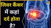 Liver Cancer