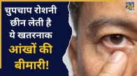 EYE Problem