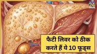 Fatty Liver Foods