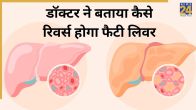 Fatty Liver Reverse