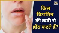 Vitamin Deficiency Dry Lips