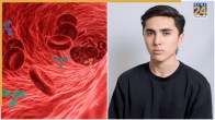 Testosterone Hormone Deficiency