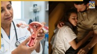 Cervical Cancer Causes