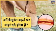 Cholesterol Pain Areas