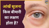 Eye Swelling Causes