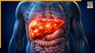 Liver Care Tips