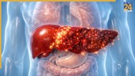 Liver Damage Signs In Morning