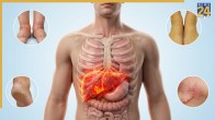 Liver Damage Symptoms