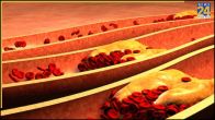 Vein Blockage