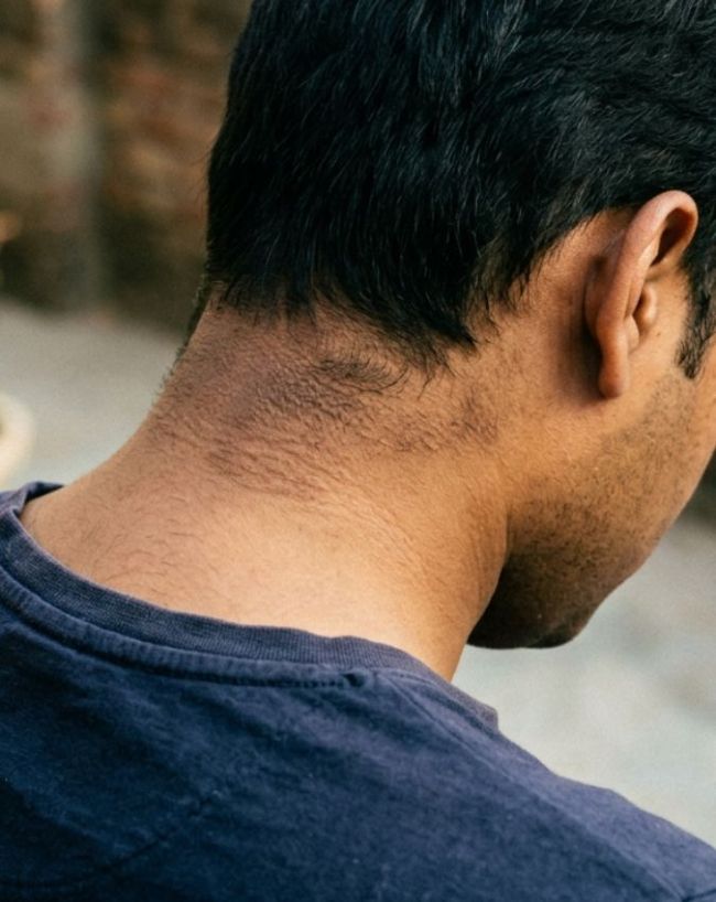 कुछ हिस्सों का काला दिखना 