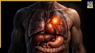 Cancer Early Detection