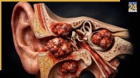 Ear Cancer Symptoms