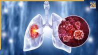 Meat Causes In Cancer