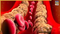 High Cholesterol Dinner Foods