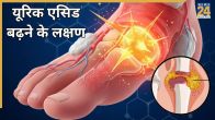 uric acid badhne ke lakshan
