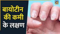 Biotin Ki Kami Ke Lakshan