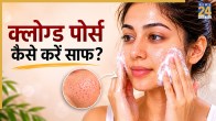 Clogged Pores Cleaning