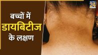 Diabetes In Children Signs