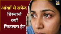 Heat Stroke Harmful on Eye