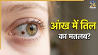 Eye-Mole