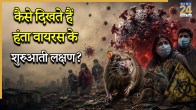 Hantavirus Symptoms