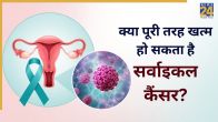 cervical cancer