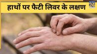 Fatty Liver Symptoms In Hindi