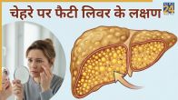 Fatty Liver Symptoms In Hindi