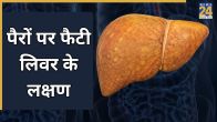 Fatty Liver Signs in Feet