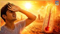 Human Skin Burning Temperature