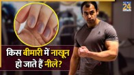 Prateek Yadav Health News