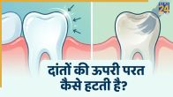 Reasons Why Teeth Enamel Wears Off