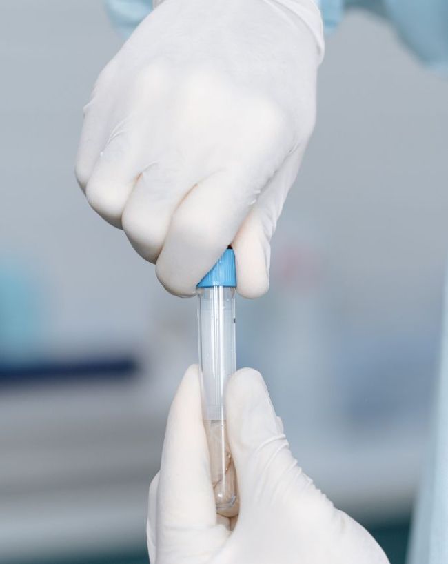क्रिएटनिन ब्लड टेस्ट और eGFR 