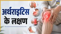 Arthritis Symptoms