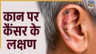 Ear Cancer Symptoms