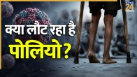 Polio virus