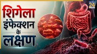 Shigella infection