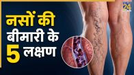 naso ki bimari ke lakshan